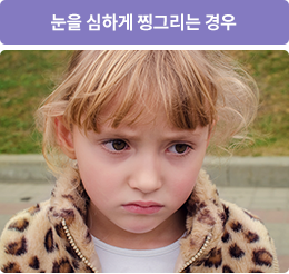 눈을 심하게 찡그리는 경우